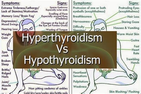 Hyperthyroidism Vs Hypothyroidism | Hyperthyroidism And Hypothyroidism