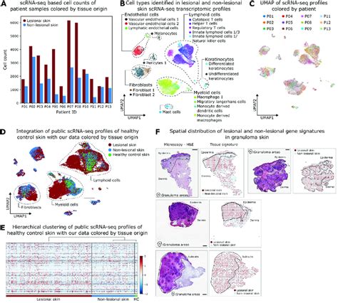 Figure S1 ScRNA Seq Identifies Immune And Structural Cells Of Lesional