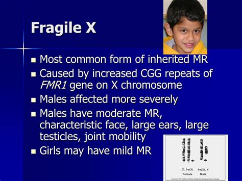 Ppt Genetic Aspects Of Autism Powerpoint Presentation Free Download Id4750427