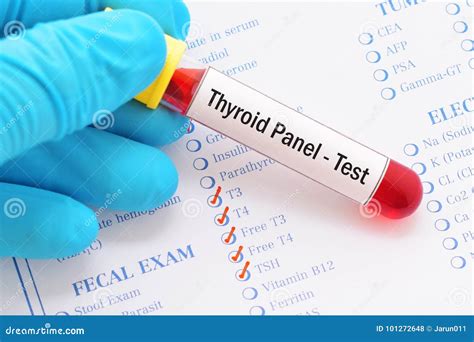 Thyroid Panel Test Stock Photo Image Of Hormone Medicine 101272648