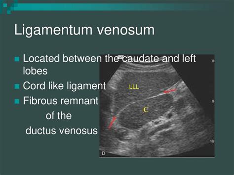 Lackawanna College Diagnostic Medical Sonography Program Ppt Download