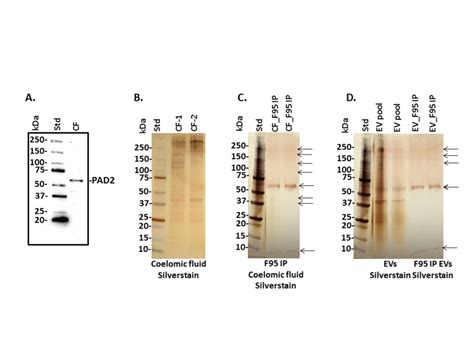 Peptidylarginine Deiminase Pad Like Protein Detection And Deiminated