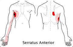 Anterior Chest Pain Presentation