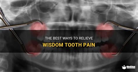 The Best Ways To Relieve Wisdom Tooth Pain MedShun