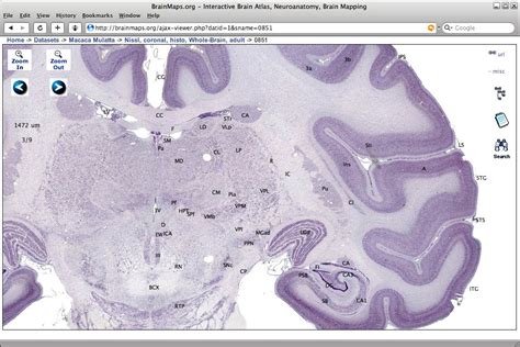 Brain Anatomy Map : Human Brain Poster - Clinical Charts and Supplies ...