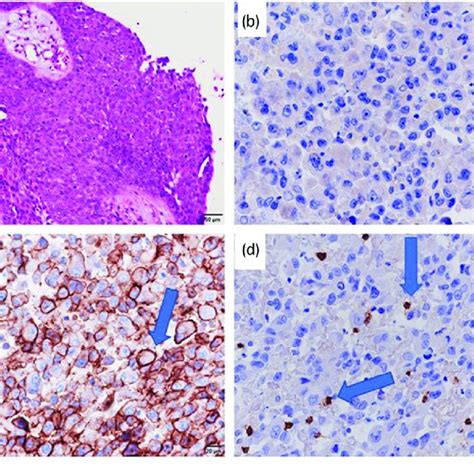 Pathological Findings A Hematoxylin And Eosin Staining Of The Right