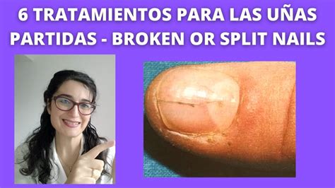 Treatment for BROKEN NAILS or SPLIT NAILS 6 TrataMientoS para UÑAS