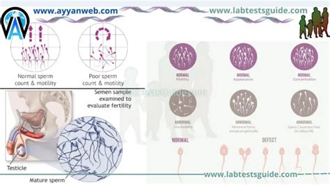 Semen Analysis Procedure Parameters And Interpretation Importance