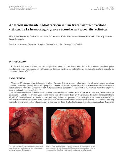 PDF Ablación mediante radiofrecuencia un tratamiento scielo isciii