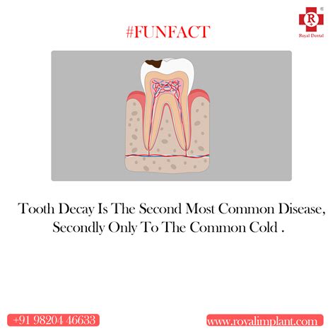 Diagnosis and treatment for Tooth Cavity? - Royal Dental Clinics Blog