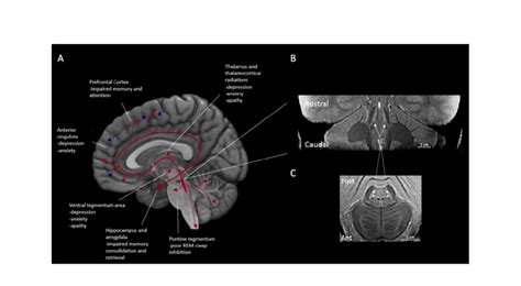 A) schematic sagittal view of the brain, illustrating locus coeruleus... | Download Scientific ...