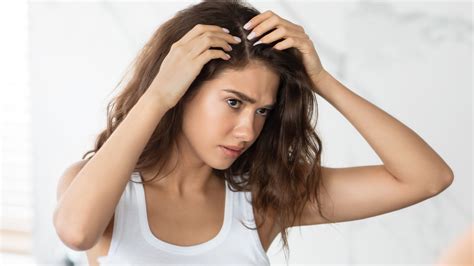 Stop Believing These Myths About Dandruff