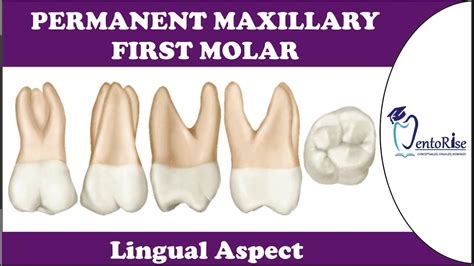 Permanent Maxillary First Molar Lingual Aspect Tooth Morphology