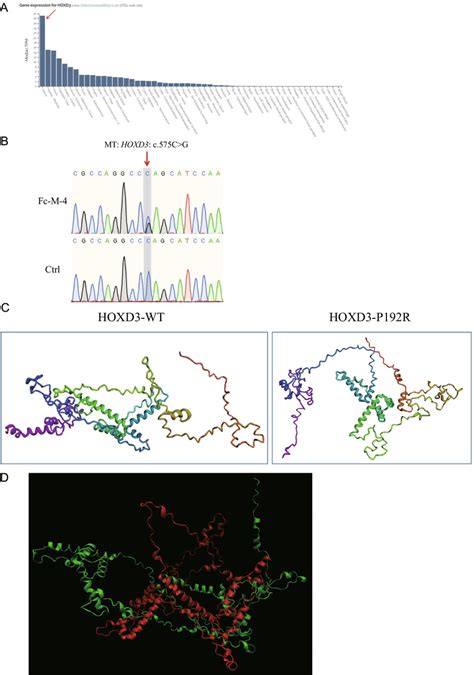 Hoxd Variant Is Associated With Mrkh Syndrome Ahoxd Is Highly