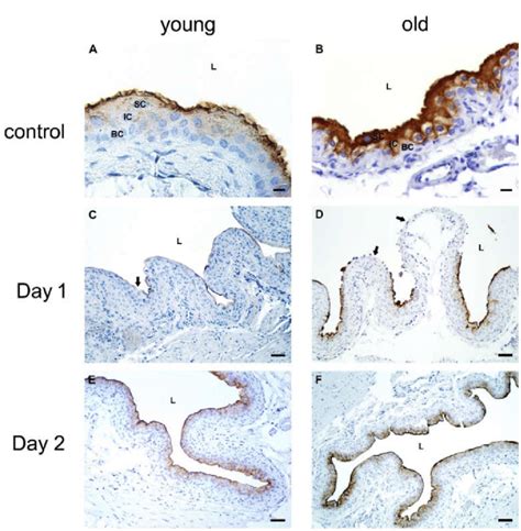 Representative Micrographs Of Immunohistochemical Detection Of