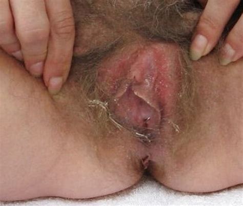 Dirty Smegma Pussy Mega Porn Pics