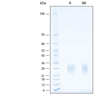 Recombinant Human Nkp Ncr His Tag Protein Cf Nk R D Systems