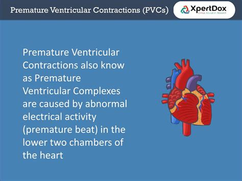 PPT Premature Ventricular Contraction PowerPoint Presentation Free