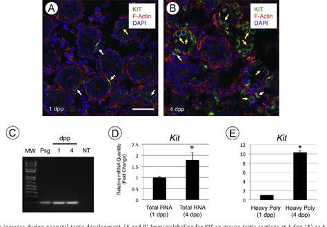 Figure From Retinoic Acid Regulates Kit Translation During