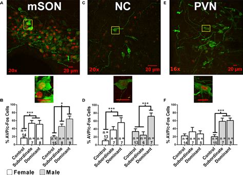 Immunofluorescent Colocalization Of Avp Ir Green And Fos Ir Red