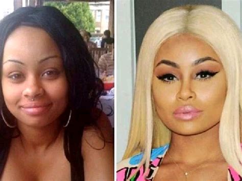 Celebrities Who Bleached Their Skin Before And After Photos Boombuzz