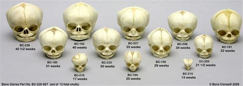 None Of Your Neurones Know Who You Are Can Skull Theory Reveal Sex Of An Unborn
