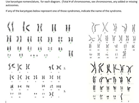 Down Syndrome Karyotype Chart