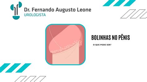 O Que S O Essas Bolinhas No Penis Dr Fernando Leone Urologista Bh