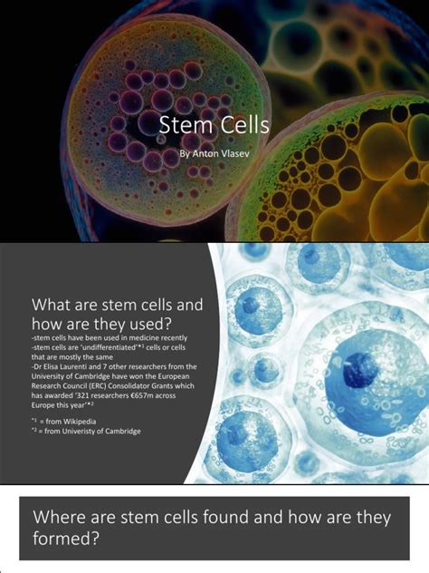 Stem Cells in Cancer Treatment | PDF | Stem Cell | Hematopoietic Stem Cell Transplantation