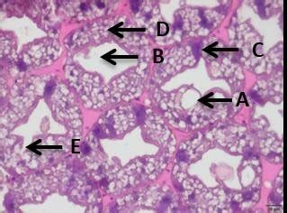 Histopathology Of Tiger Prawn Hepatopancreas Infected With White Feces