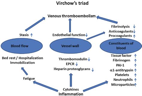 Virchow S Node