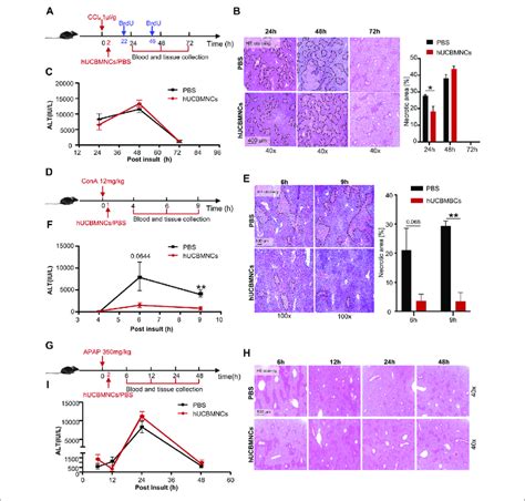 HUCBMNCs Treatment Improved CCl 4 ConA Induced Liver Injury But Did