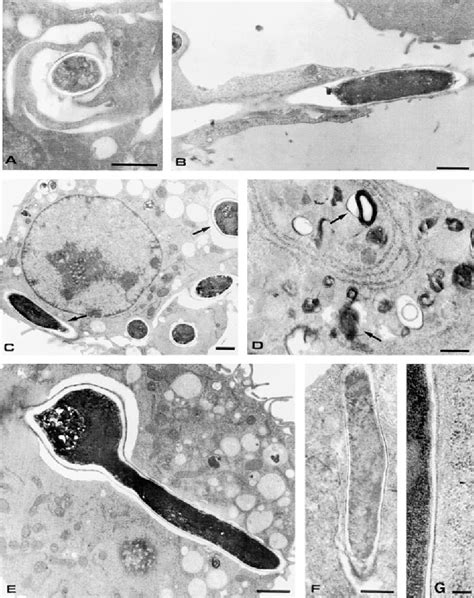 Figure From Dendritic Cells Discriminate Between Yeasts And Hyphae Of