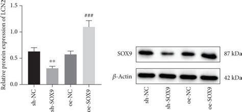 Sox9 Upregulates Lcn2 Expression A A Heat Map Of Degs Between 151