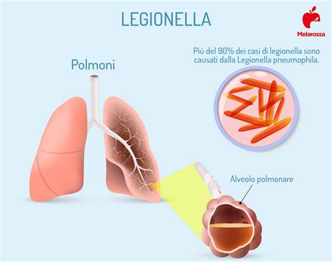 Legionella cosè caratteristiche contagio sintomi cure e prevenzione