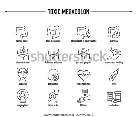 Toxic Megacolon Symptoms Diagnostic Treatment Vector Stock Vector (Royalty Free) 2369975017 ...