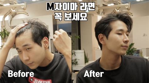 Mens Hair 얇고 힘없는 M자머리도 풍성하게 드라이 하는법 난이도 최하 Youtube