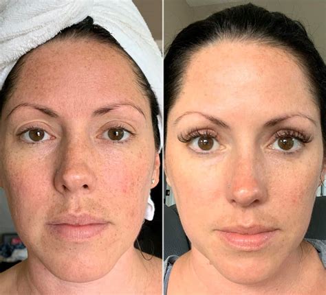 Monat Skin Care 30 Day Review Blog Skin Care Facial Spa Types Of