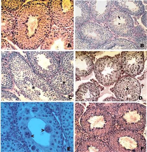 Pas Hematoxylin Stained Sections Of Mouse Testis Magnifications A D