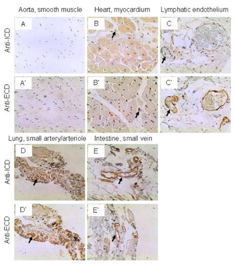 Il 17rc Expression In The Cardiovascular System Arrows Endothelium