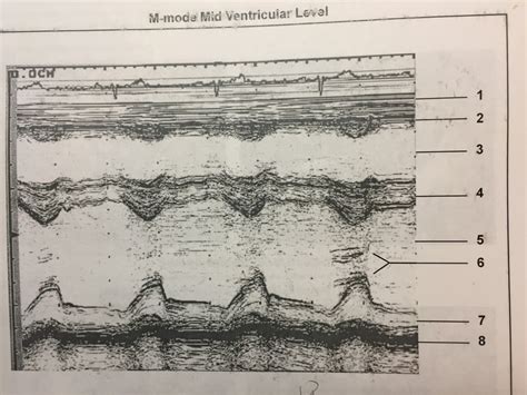 M Mode Mid Ventricular Mid Papillary Diagram Quizlet