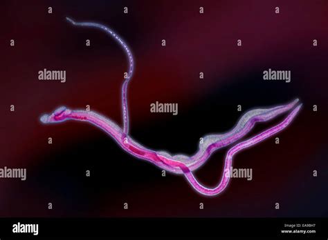Exame De Schistosoma No Sangue - Schistosoma sp in copula immagini e fotografie stock ad alta ...