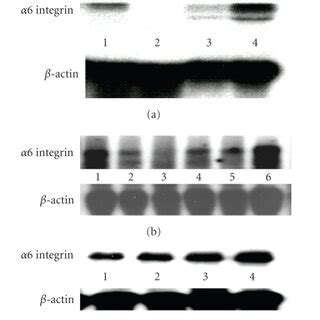 Tsp Induces Integrin Mrna Expression In Human Breast Cancer Cells