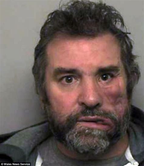 life  husband disfigured   shot   murdering