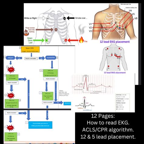 Ekg Rhythm Ecg Dysrhythmia Interpretation Acls Cpr Lab Values