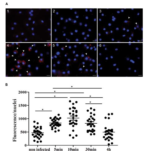 Figure From Cd Sema D Increases Macrophage Infection By Leishmania