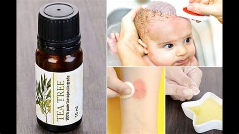 7 Ways To Use Tea Tree Oil For Fungal Infections Ringworm Jock Itch Youtube