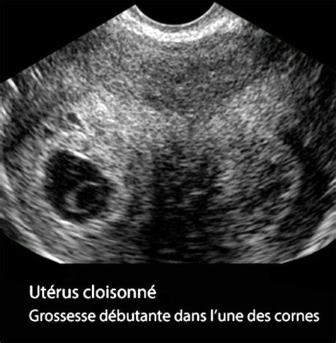 Uterus Cloisonne 10 Dr KARA ZAITRI M A