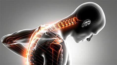 Tratamento Da Dor Lombar E Ergonomia Do Escrit Rio Exerc Cios De