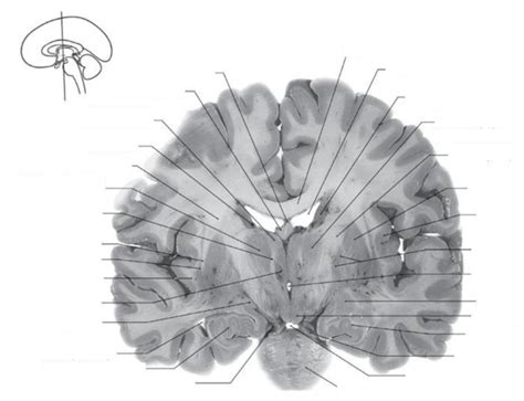 diagram  coronal view   brain neurolab quizlet